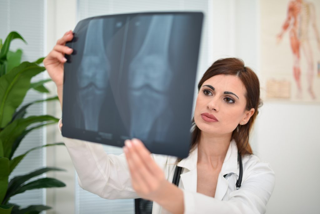 Xray for knee arthritis is available at One Ashford Hospital in Kent