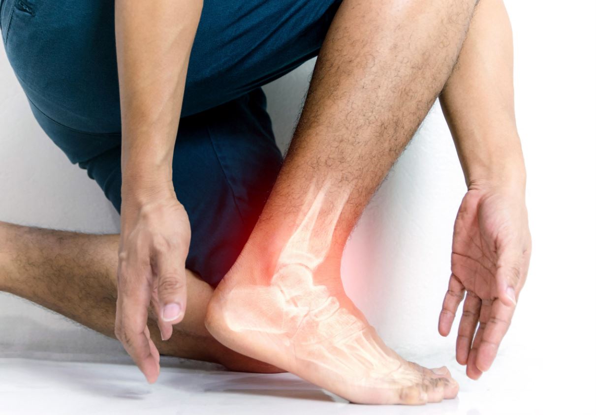 Heel pain might be plantar fasciitis - Mayo Clinic Health System